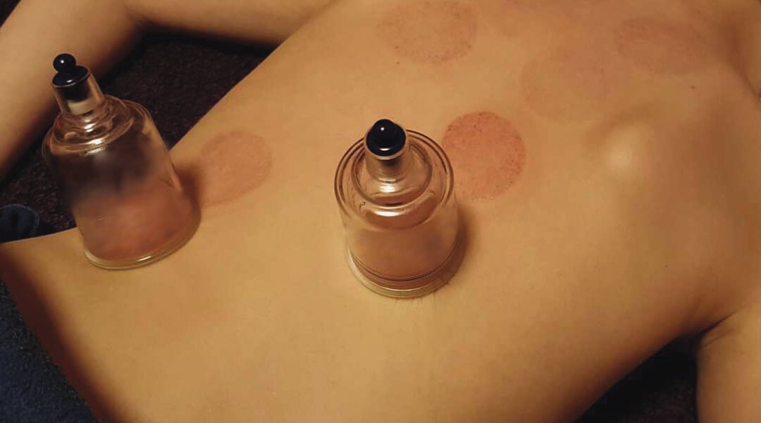 Alam Beauty & Wellness Spa -60-min | Cupping + Massage